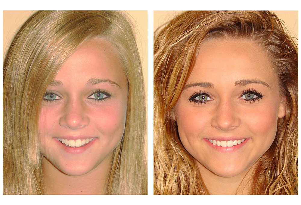 Longo Dietz Orthodontics